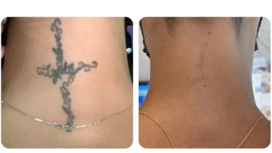 3 Sessions of Laser Tattoo Removal on Small, Medium or Large Area from AED 399